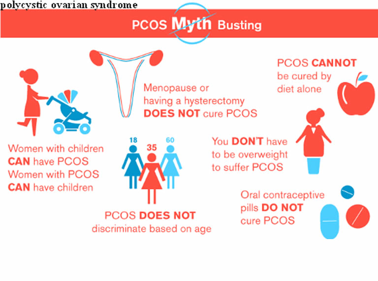 polycystic ovaries treatment pregnancy