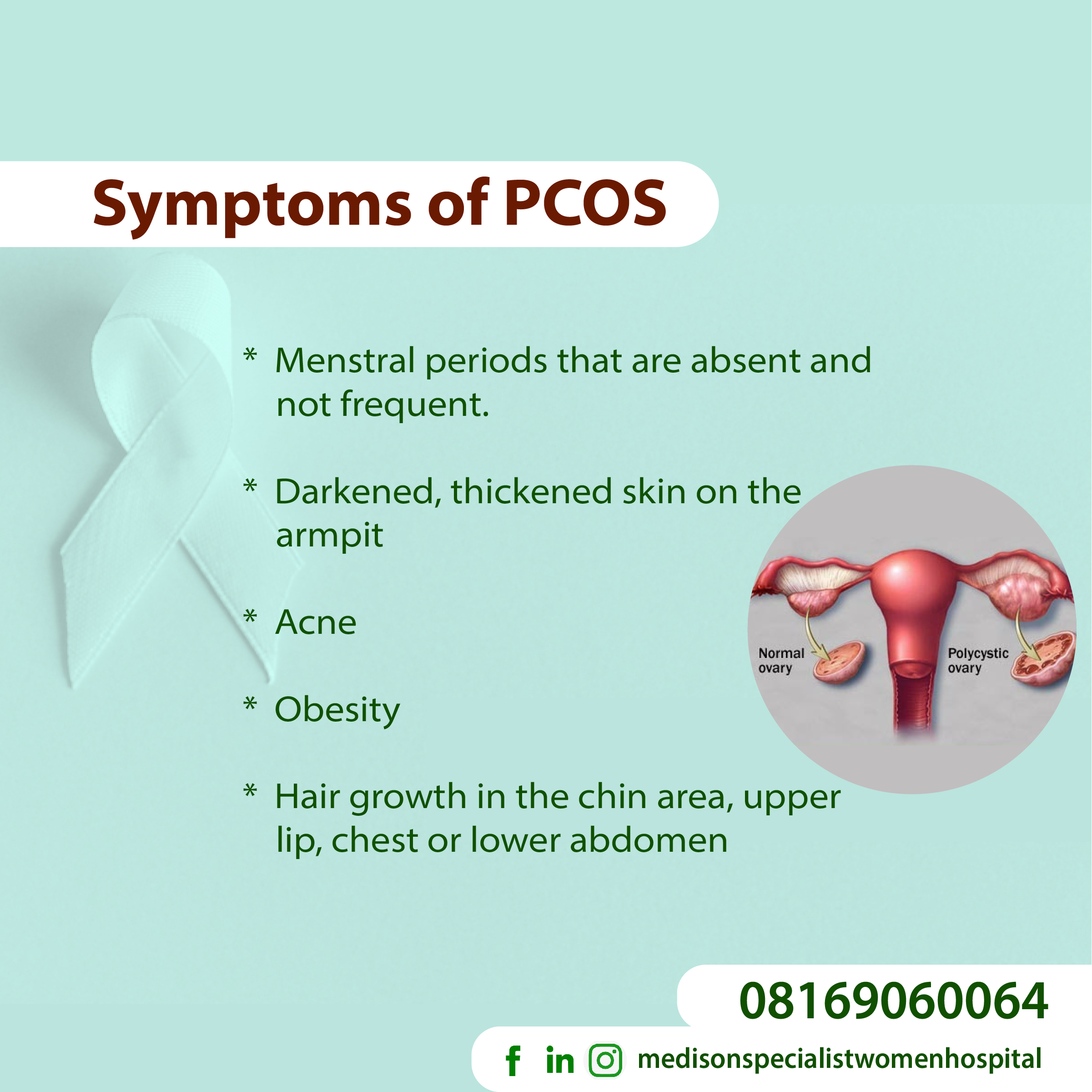 PCOS things you should know-03