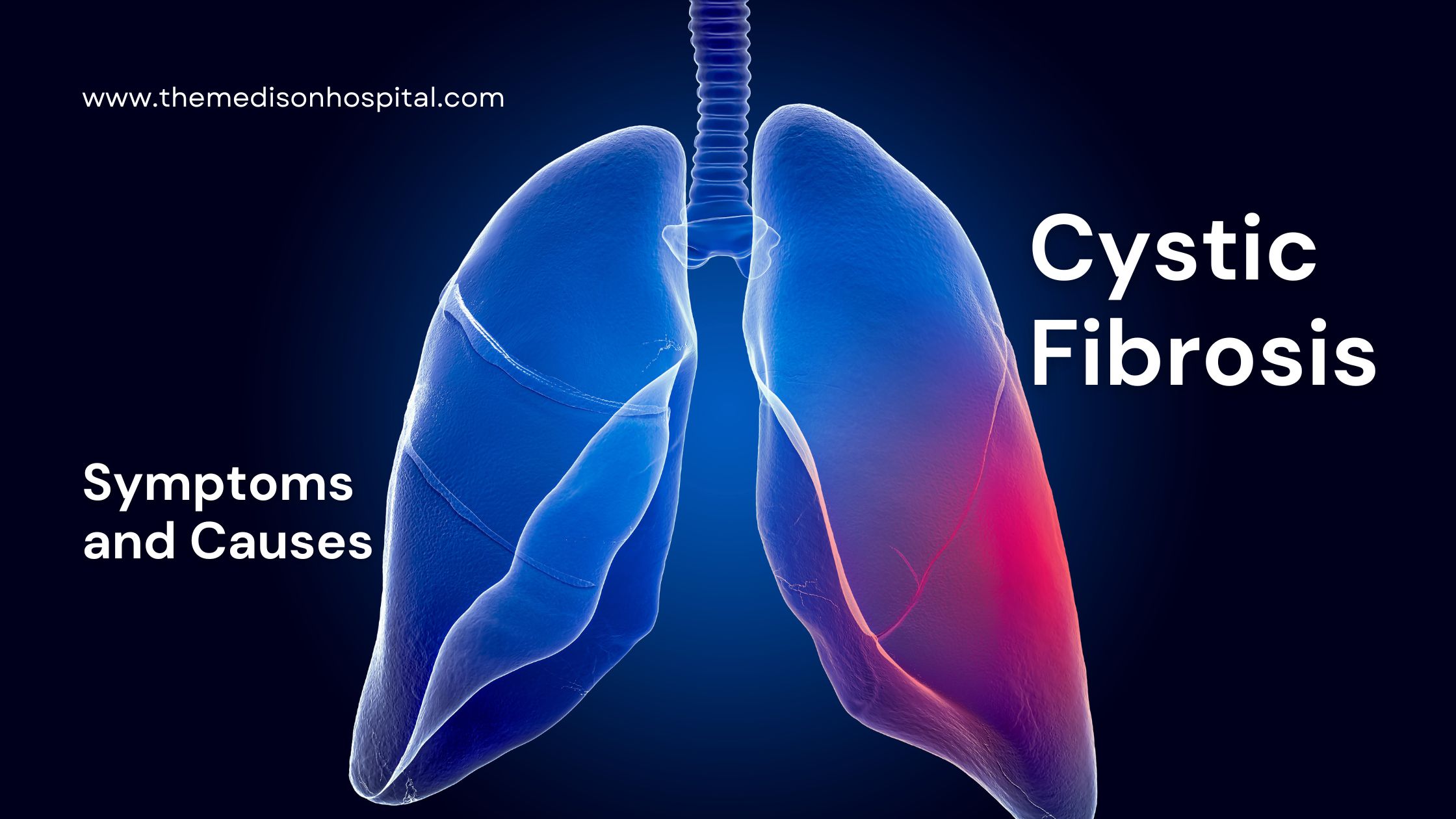 Cystic Fibrosis: Symptoms and Causes