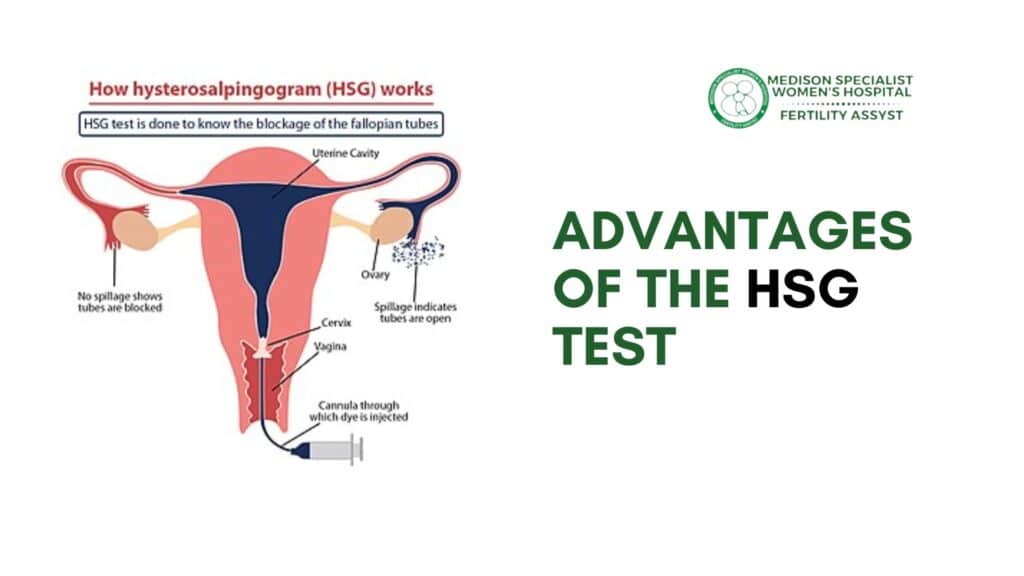 advantages of the HSG test