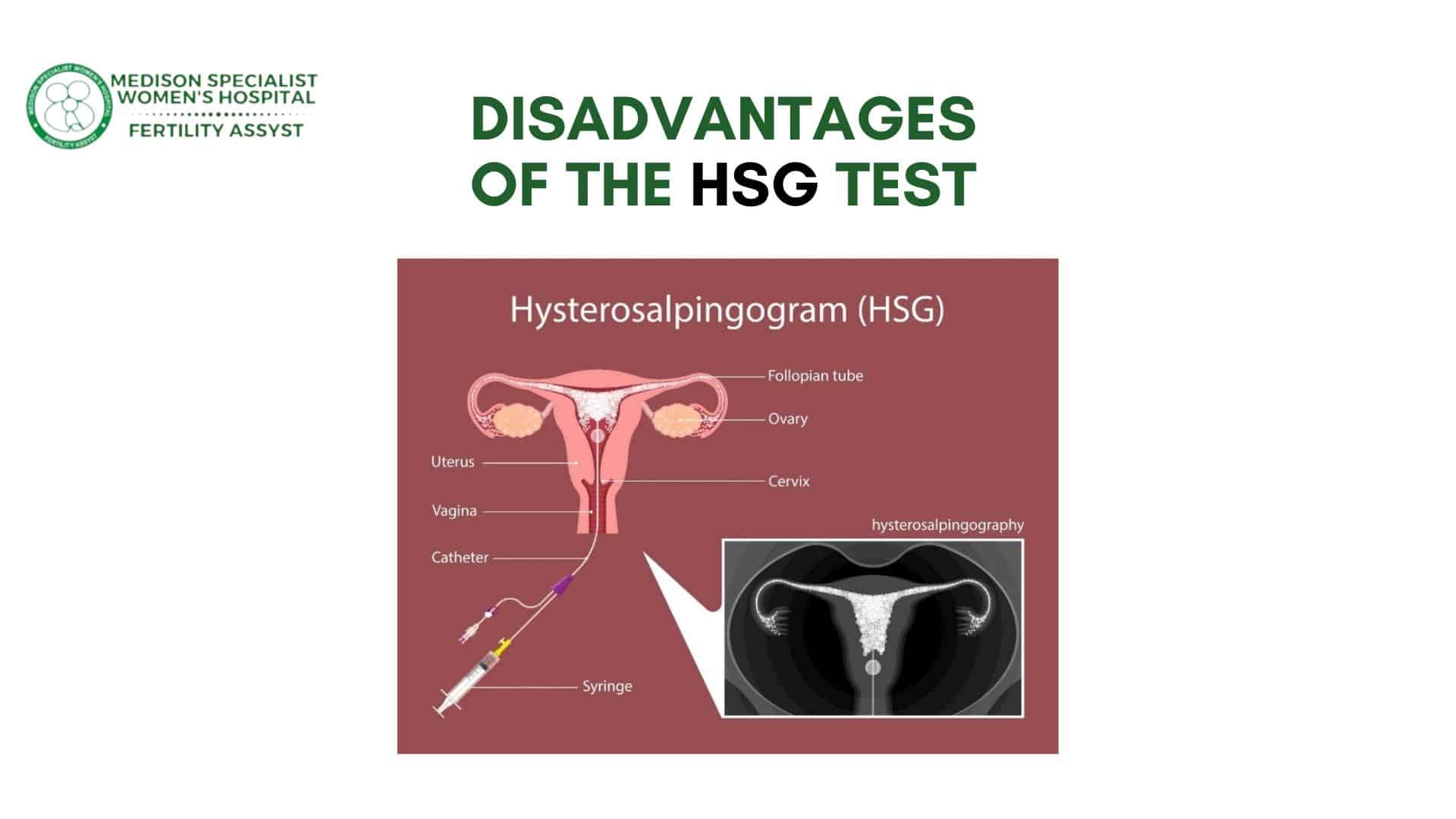 disadvantages of the HSG test