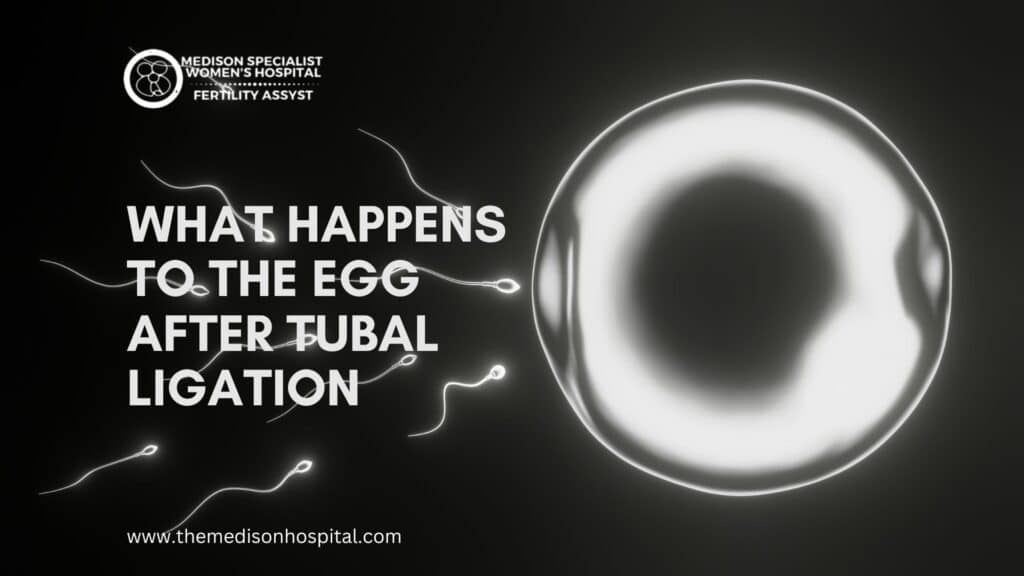 Egg Tubal Ligation