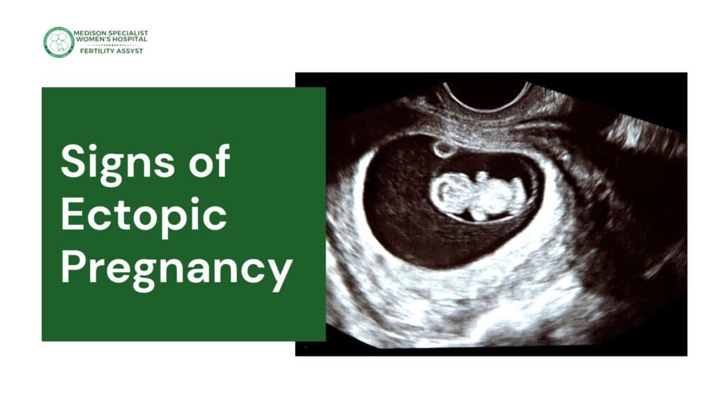 Signs of Ectopic Pregnancy 
